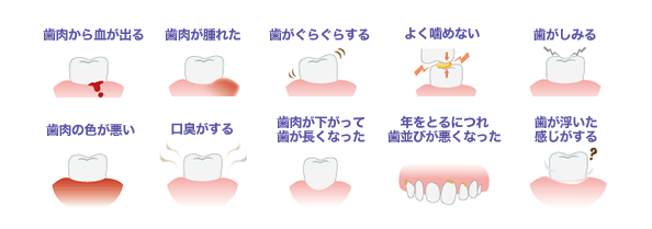 歯周病の症状